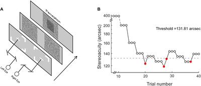 Optimal Stereoacuity Reveals More Than Critical Time in Patients With Intermittent Exotropia